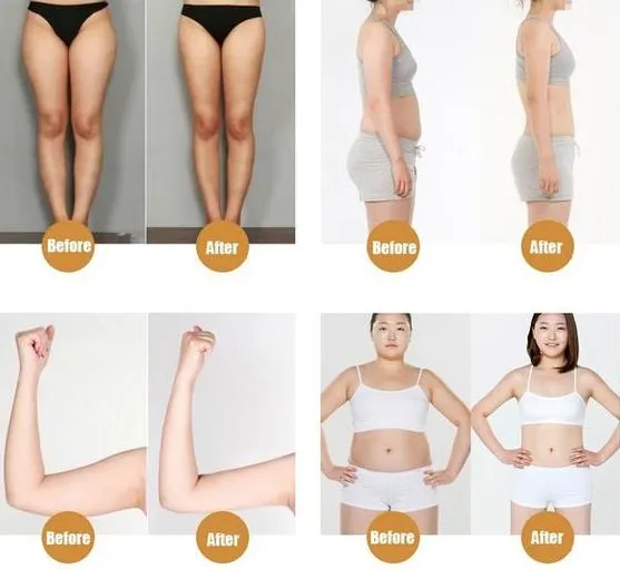 MagnaCure™ Metabolism Boosting Patch